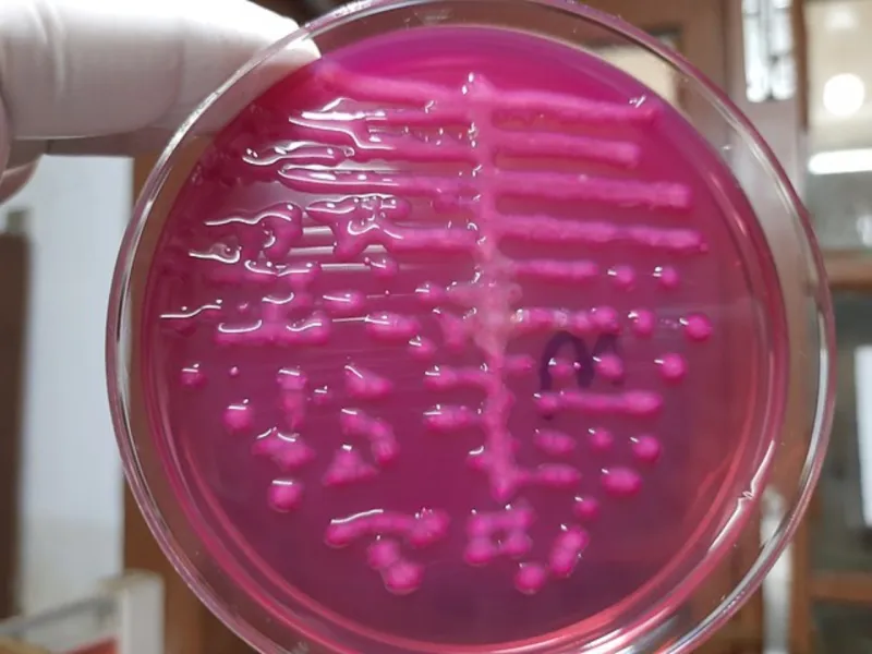 BACTERIA KLEBSIELLA OXYTOCA